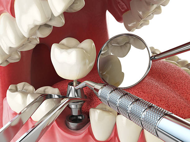 Best Emergency Cosmetic Dentistry in Honaker, VA